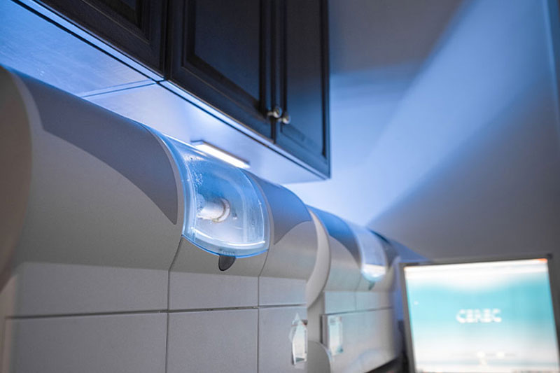 Intra-Oral Scanner in Clovis