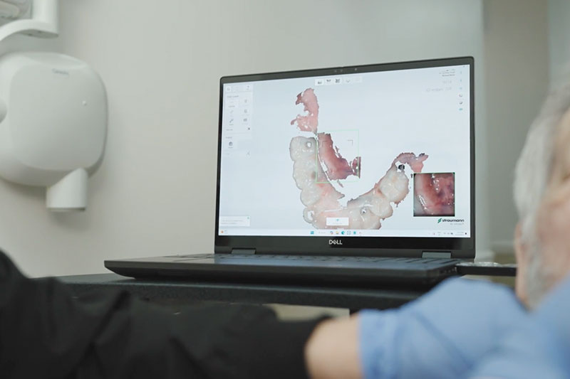 Dr. Surdeep Singh uses CEREC Same Day Dentistry in Clovis