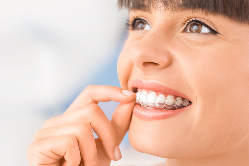 Invisalign in Clovis